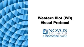 Western Blot WB Visual Protocol [upl. by Mandy]