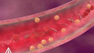 Cholesterol  3D Medical Animation [upl. by Indyc712]