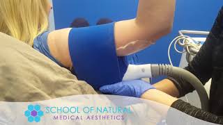 Coolsculpting Training for Medical Astheticians [upl. by Rovner674]