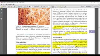 COPD  Respiratory Medicine  UrduHindi  Davidson Medicine [upl. by Lind747]