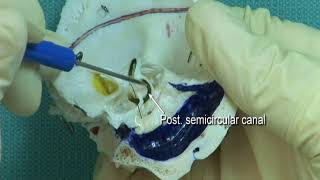 17 Step 6 Position and orientation of the semicircular canals [upl. by Hoffarth]