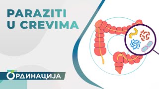 Paraziti u crevima  RTS ordinacija cela emisija [upl. by Suiratnauq229]