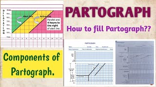 PARTOGRAPH COMPONENTS OF PARTOGRAPH HOW TO FILL OR PLOT PARTOGRAPH [upl. by Reni355]