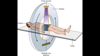 How CT Scan Machine Works [upl. by Sidonie73]