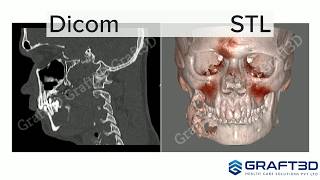 Capabilities of D2P  DICOM to PRINT Software [upl. by Accire329]