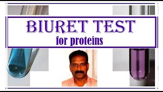 BIURET Test for Protein BIOCHEMISTRY CLASSES [upl. by Arne]