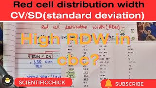 Red cell distribution widthrdwcvrdwsdstandard deviation [upl. by Franciskus]