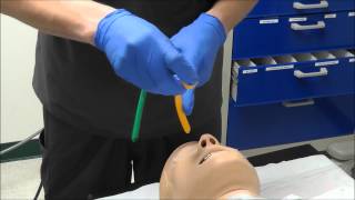 Nasal Intubation [upl. by Naitsihc]