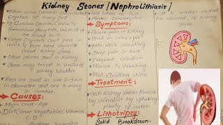 Kidney stonesNephrolithiasisCausesSymptoms and Treatmenteducationalvideoseducation [upl. by Yeneffit63]