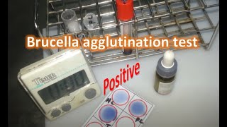 Brucella rapid agglutination test [upl. by Atekihs]