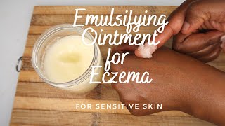 Homemade Eczema Ointment [upl. by Pry]