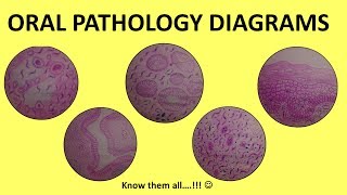 Oral Pathology Diagrams  BDS Third Year  Histopathology [upl. by Erde701]