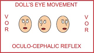 DOLLS EYE MOVEMENT OCULOCEPHALIC REFLEXVESTIBULOOCULAR REFLEX [upl. by Hank]