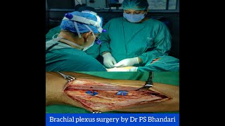 Brachial plexus surgery by Dr PS Bhandari [upl. by Fagan]