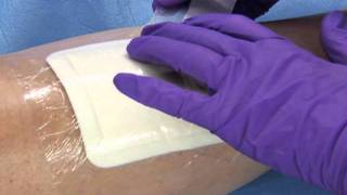 3M™ Tegaderm™ Foam Adhesive Dressing  Application and Removal [upl. by Ailecec797]