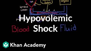 Hypovolemic shock  Circulatory System and Disease  NCLEXRN  Khan Academy [upl. by Aiek]