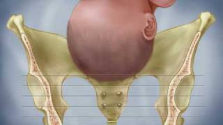 Fetal Descent Birth Station Progress Dilation Effacement Labor Contractions [upl. by Ena]