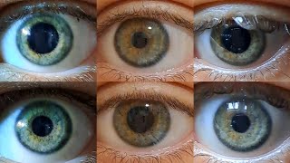 shrinking and dilating my pupils competition [upl. by Ernaline]