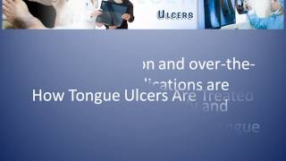 What Causes Ulcers on Tongue and How to Treat It [upl. by Tonya126]