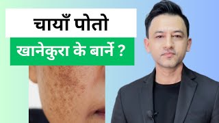 Foods to avoid in Melasma  Dr Prakash Acharya [upl. by Jaimie]