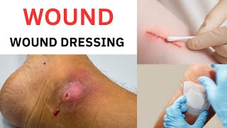 Wound  Classification  Wound Dressing [upl. by Adieno]