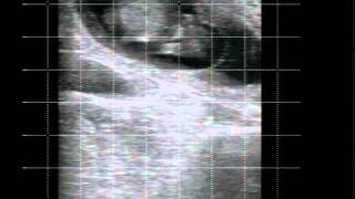 BoviScan Veterinary Ultrasound 48 day bovine pregnancy [upl. by Aneeb]