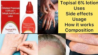 Topisal 6 lotion uses in hindi  topisal 6 percent lotion uses in hindi  topisal 6 percent [upl. by Anyd]