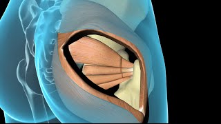 Artroplastia Total do Quadril [upl. by Nnyleuqcaj]