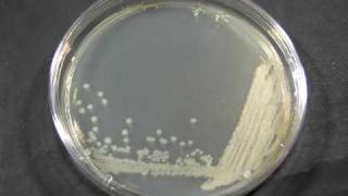 TimeLapse of Bacillus cereus growing [upl. by Neehar]