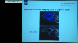 Fritz Schäfer Elastography  overview and usefulness [upl. by Jonny]