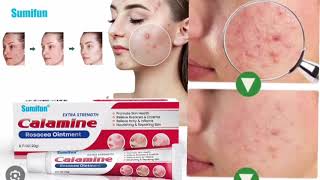 Sumifun Extra Cream Strength Calamine Rosacea Ointment Cream [upl. by Abdul496]