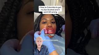 Lip Blushing GONE WRONG  Plastic Surgeon Reacts [upl. by Weisman]