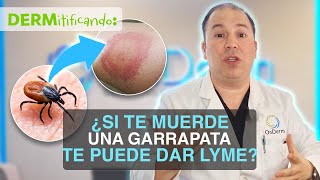 ¿Cuál es la enfermedad de Lyme [upl. by Endo]