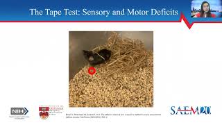 Neurological Outcomes Inflammation and the Blood Brain Barrier in a Murine Model of Cardiac Arrest [upl. by Acilef]