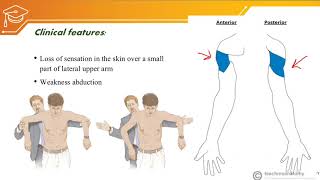 Axillary nerve injury [upl. by Niffirg334]