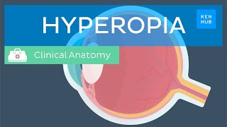 Inside the Eye Farsightedness Hyperopia [upl. by Ynnor]