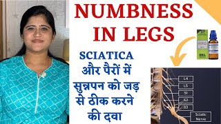 Numbness in Legs ॥ Sciatica और पैरों में सुन्नपन को जड़ से ठीक करने की दवा ॥ Gnaphalium for numbness [upl. by Hanzelin]