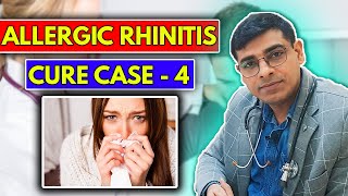 Allergic Rhinitis CURE Case No 4  Homeopathy Treatment for Allergic Rhinitis  Dr Abhik Ghosh [upl. by Nilerual573]