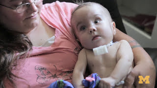 4D Implant Saves Babies with Breathing Problems [upl. by Bush]