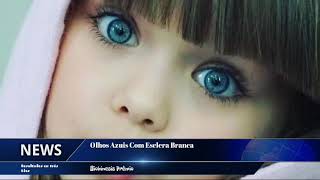 Olhos Azuis Com Esclera Branca Resultados em três Dias [upl. by Crosse928]