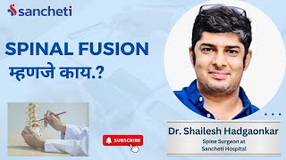 Spinal Fusion म्हणजे काय  Dr Shailesh Hadgaonkar  Spine Expert at Sancheti Hospital  Pune [upl. by Scherle171]