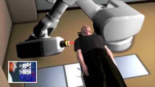 CyberKnife  Full Treatment Clip [upl. by Esiocnarf]