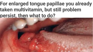 Tongue papillae enlarges you had taken multivitamin but not relieved yet then what are causes [upl. by Anaihsat]