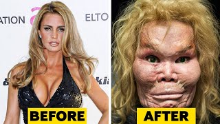 20 Celebrity Plastic Surgery Disasters [upl. by Farny]