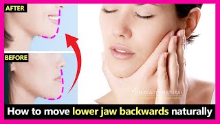 How to fix underbite protruding jaw move lower jaw backwards naturally  Prognathism jaw exercises [upl. by Neelyaj]