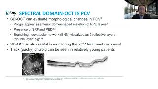 Lecture Polypoidal Choroidal Vasculopathy and Retinal Complications of Myopia [upl. by Oys]