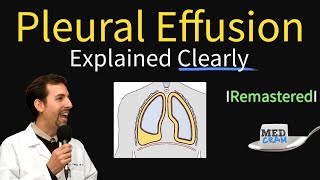 Pleural Effusions  Causes Diagnosis Symptoms Treatment [upl. by Whitcher]