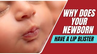 Why Your Newborn Might Have A Lip Blister [upl. by Ahsaekal]