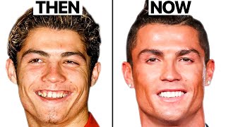 Cristiano Ronaldo NEW FACE  Plastic Surgery Analysis [upl. by Repsag626]