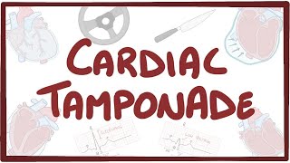 Cardiac tamponade  causes symptoms diagnosis treatment pathology [upl. by Nalliuq]